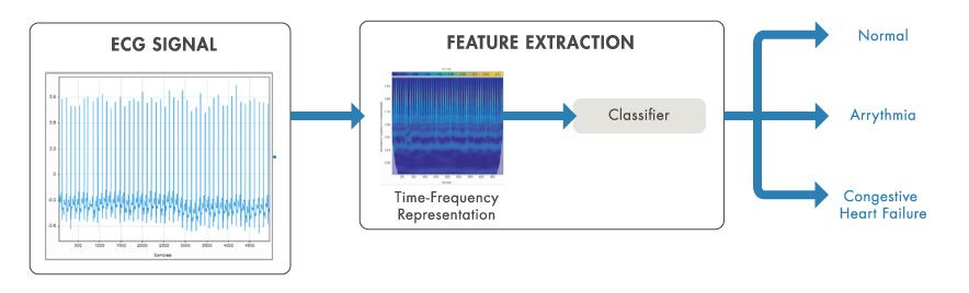 Time-frequency analysis used to extract features from ECG signals for classification.