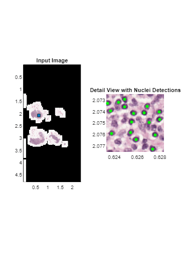 Detect and Count Cell Nuclei in Whole Slide Images