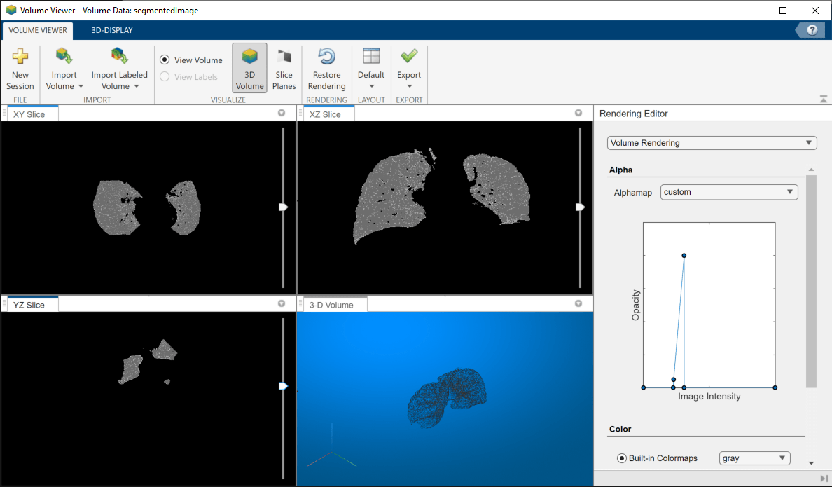 Segment Lungs from 3-D Chest Scan