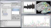 bat365 and Brainstorm engineers will demonstrate the essential tools offered by Brainstorm to analyse and visualize multidimensional, complex datasets obtained from electrophysiological recordings, with an emphasis on functional brain imaging. We 